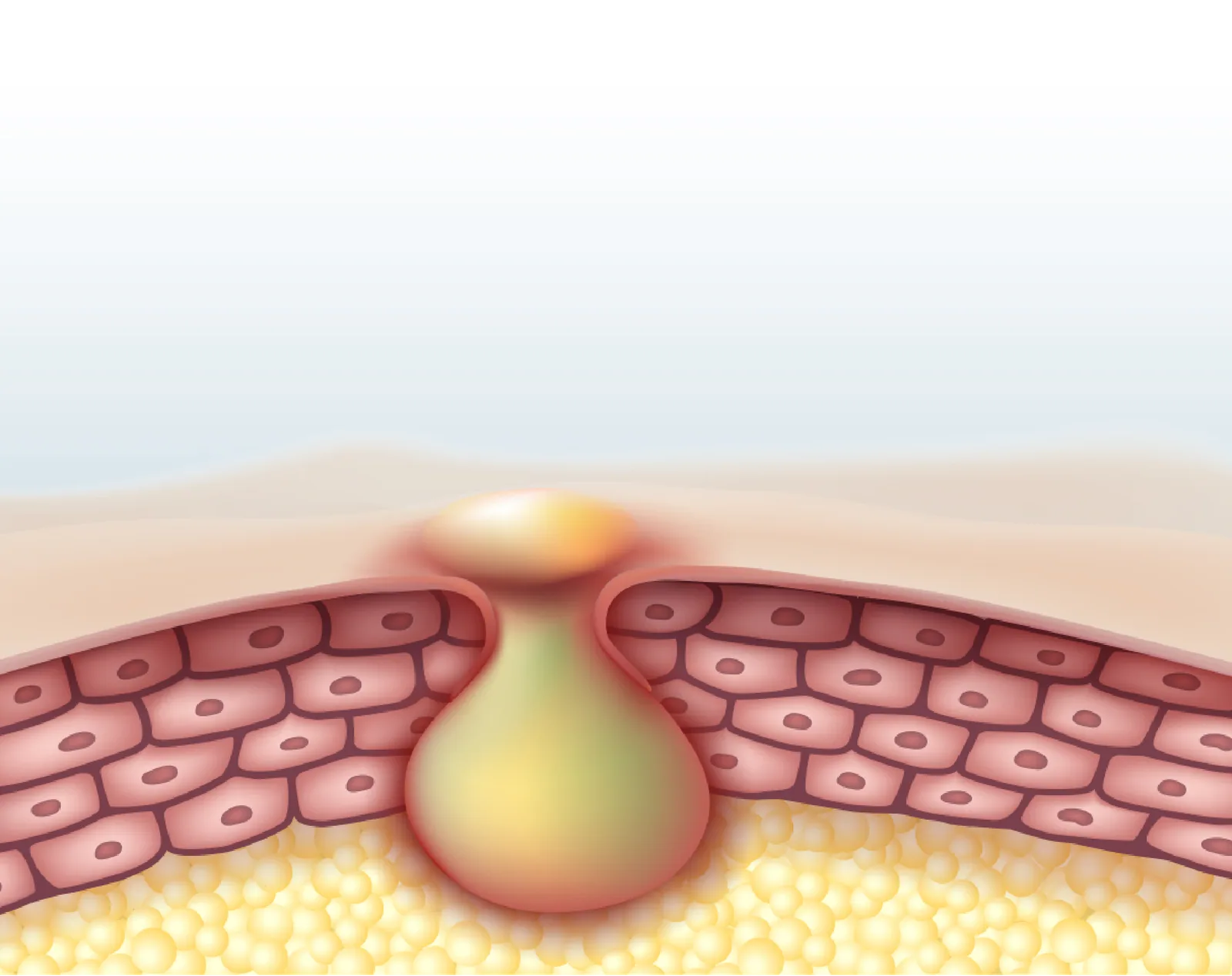 Acne assessment at Clinic RX