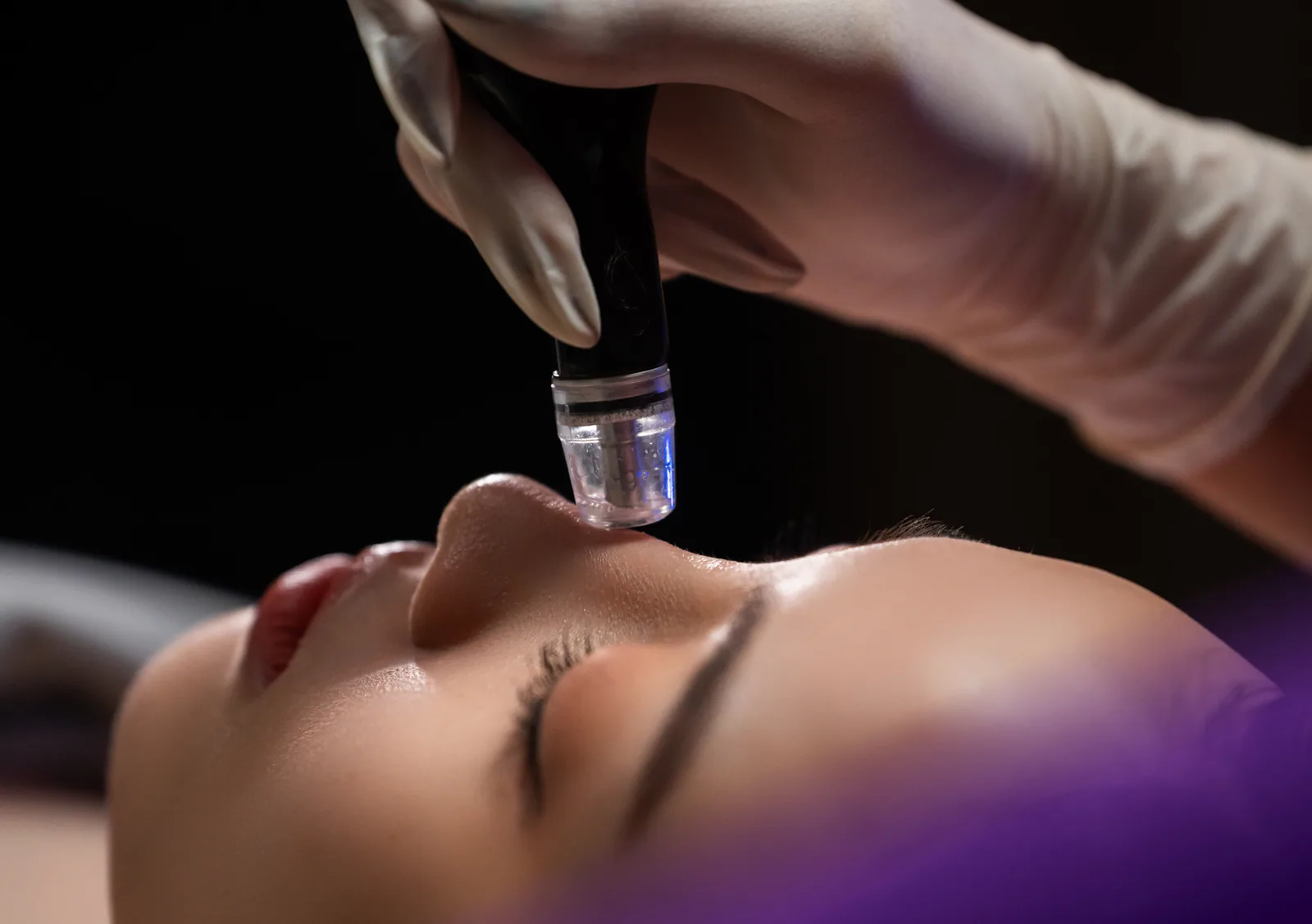Silk Infusion treatment at Clinic RX