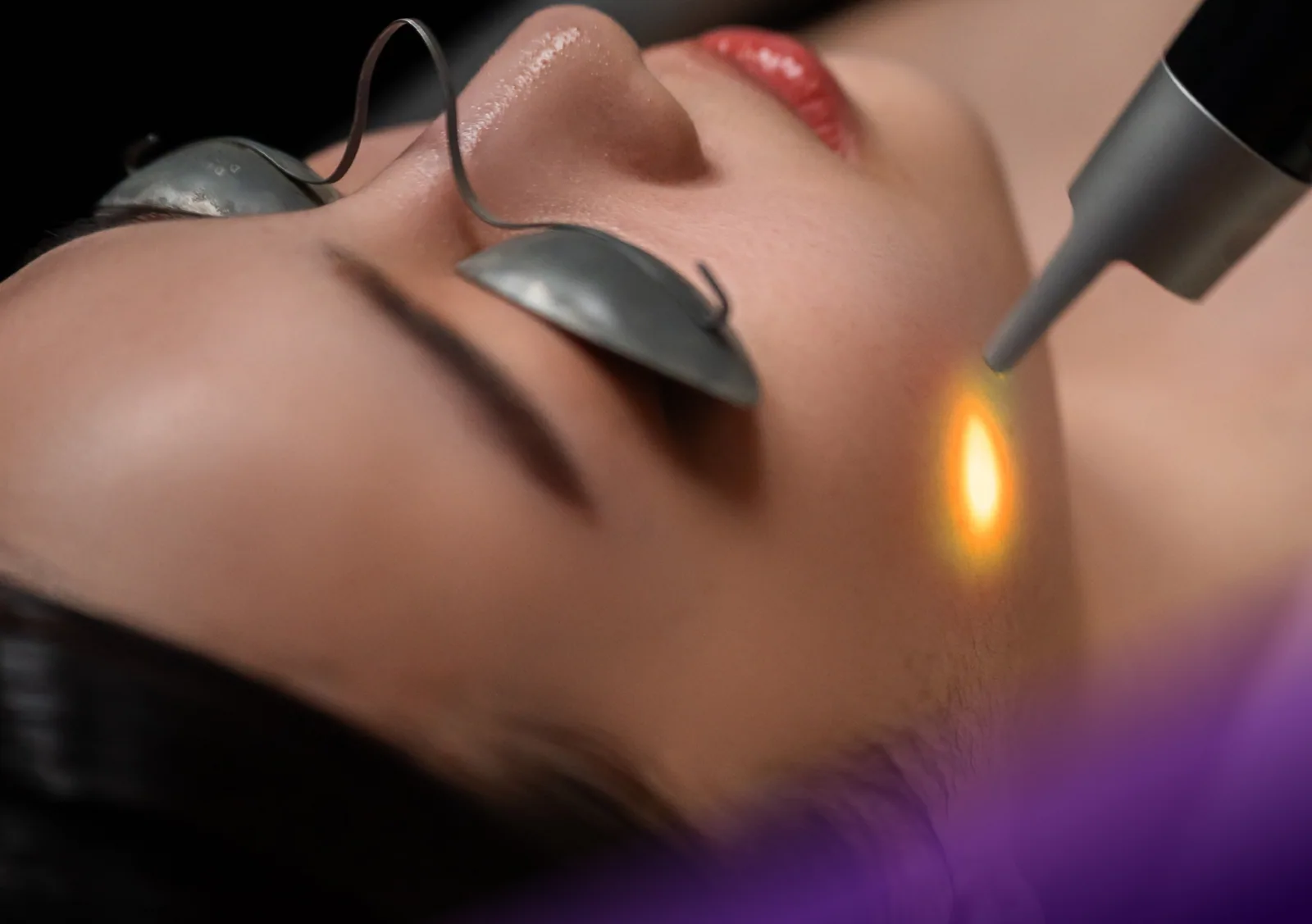 Yellow Laser treatment at Clinic RX