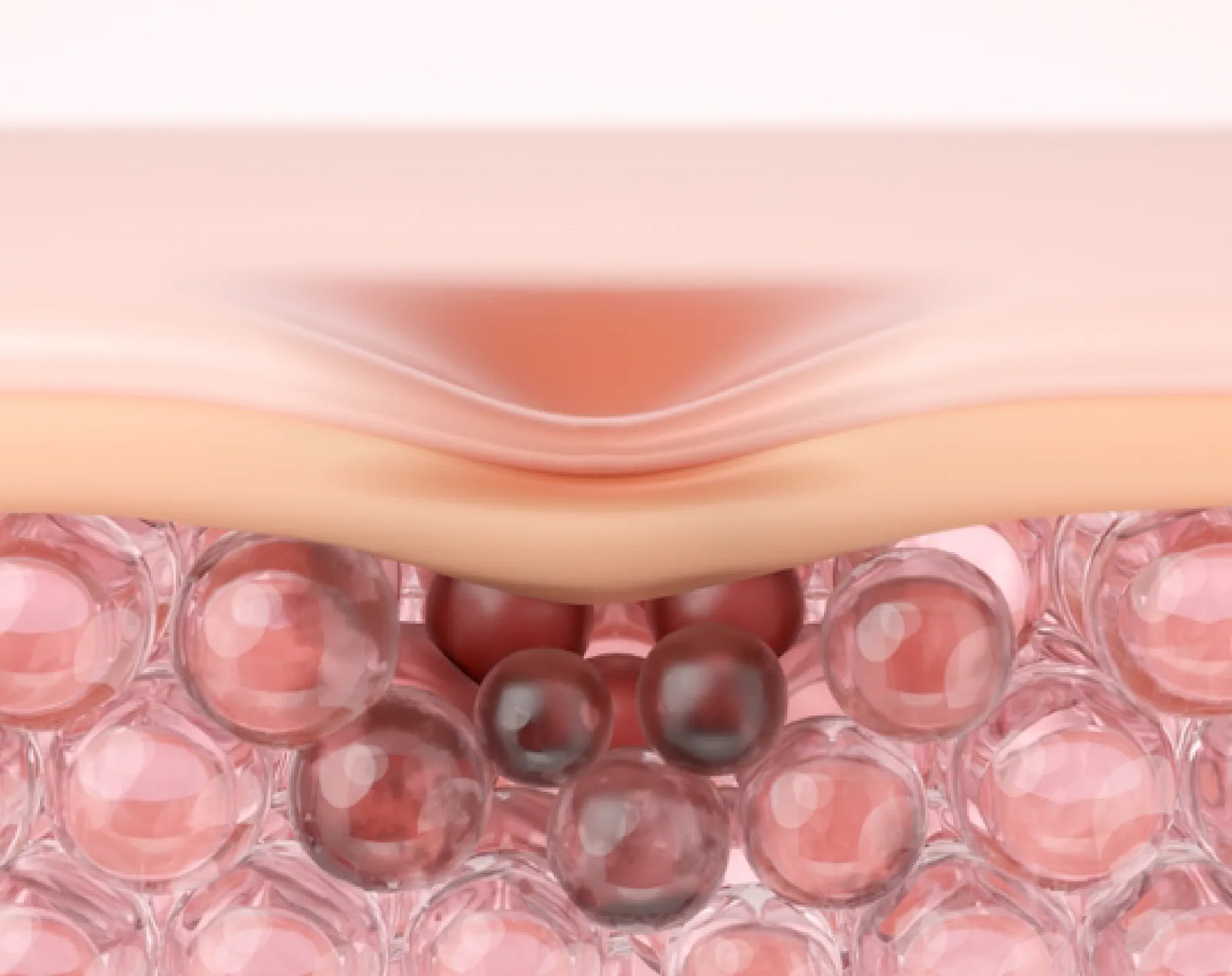 Acne Scars anatomy and overview