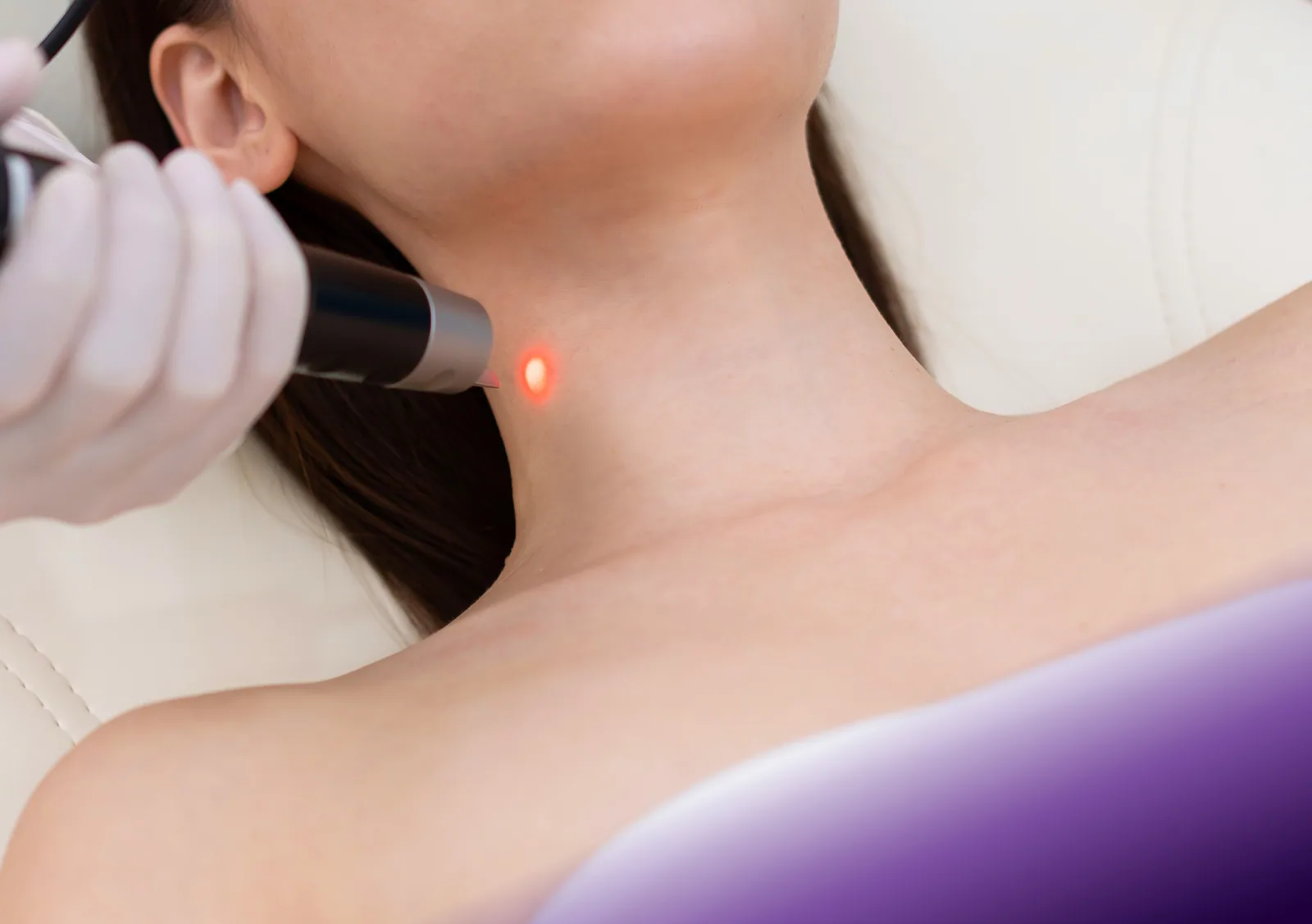Pico Laser treatment at Clinic RX