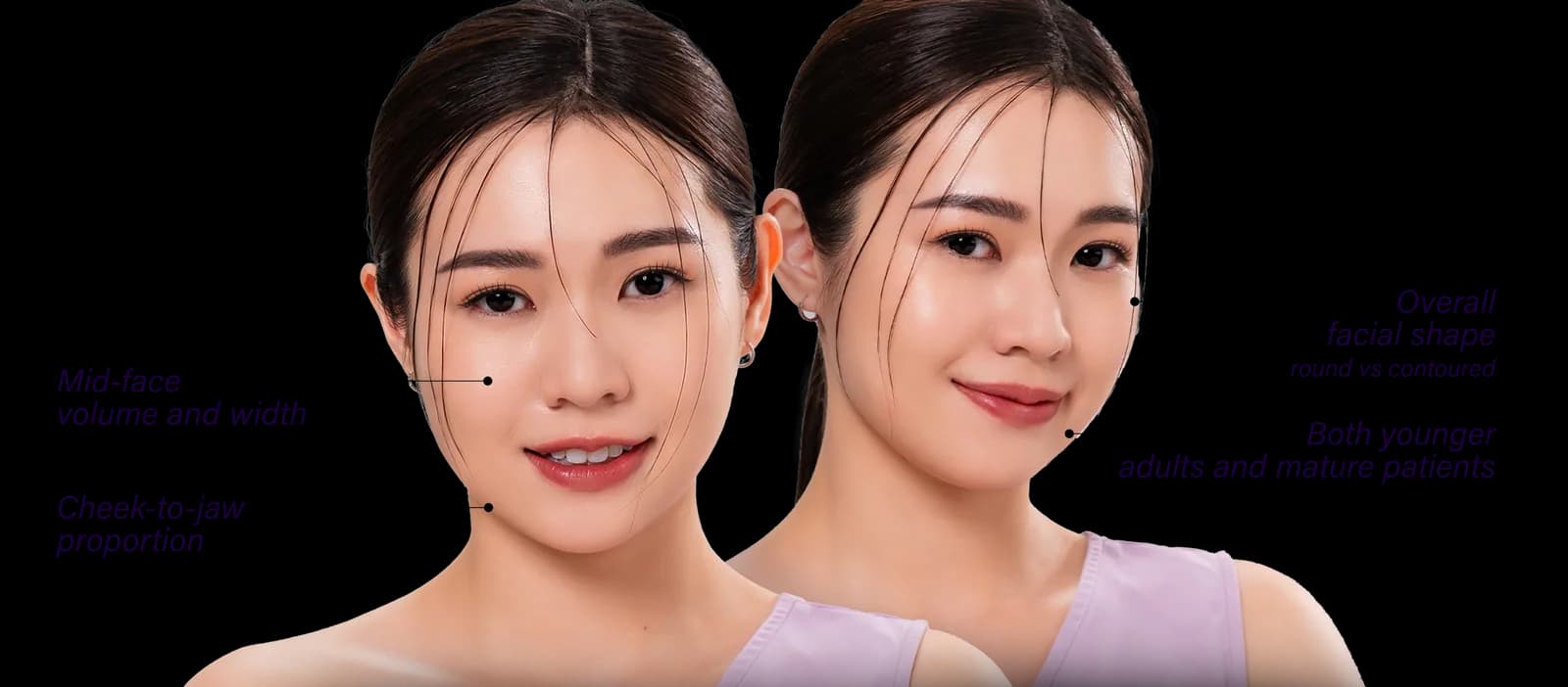 Chubby Cheeks commonly affected areas