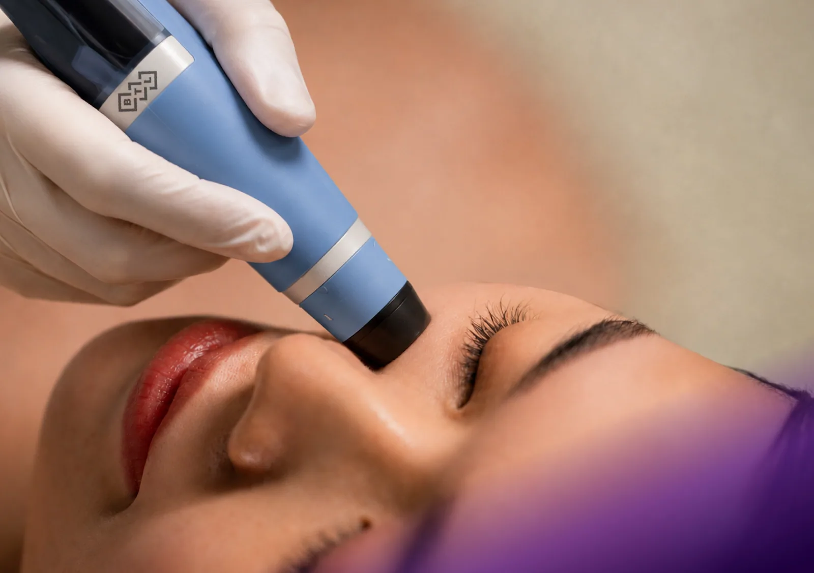 Exion treatment at Clinic RX