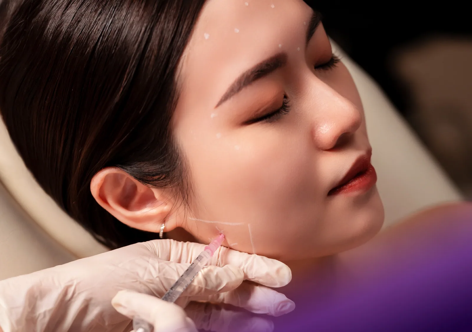 Lipo V treatment at Clinic RX