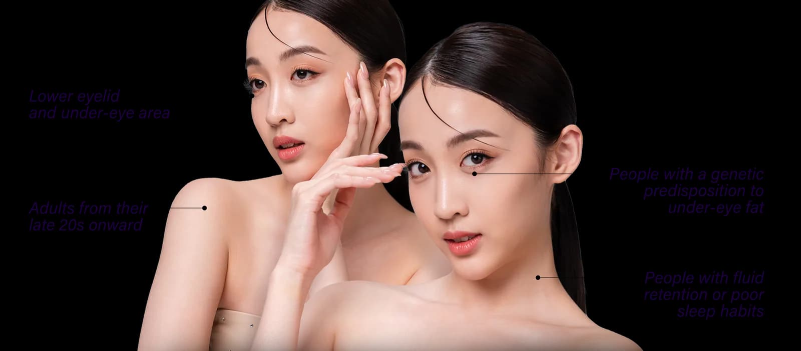 Eyebags commonly affected areas