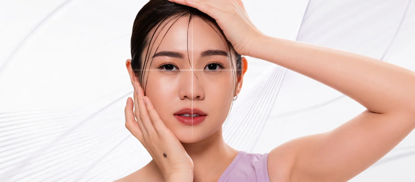 Facial Disharmony condition overview