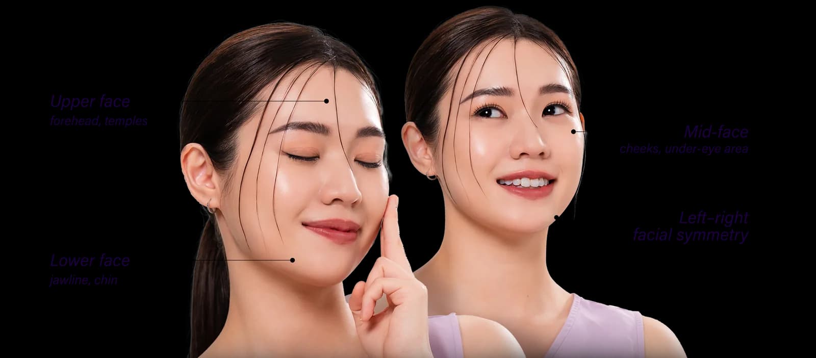 Areas of the face affected by facial disharmony