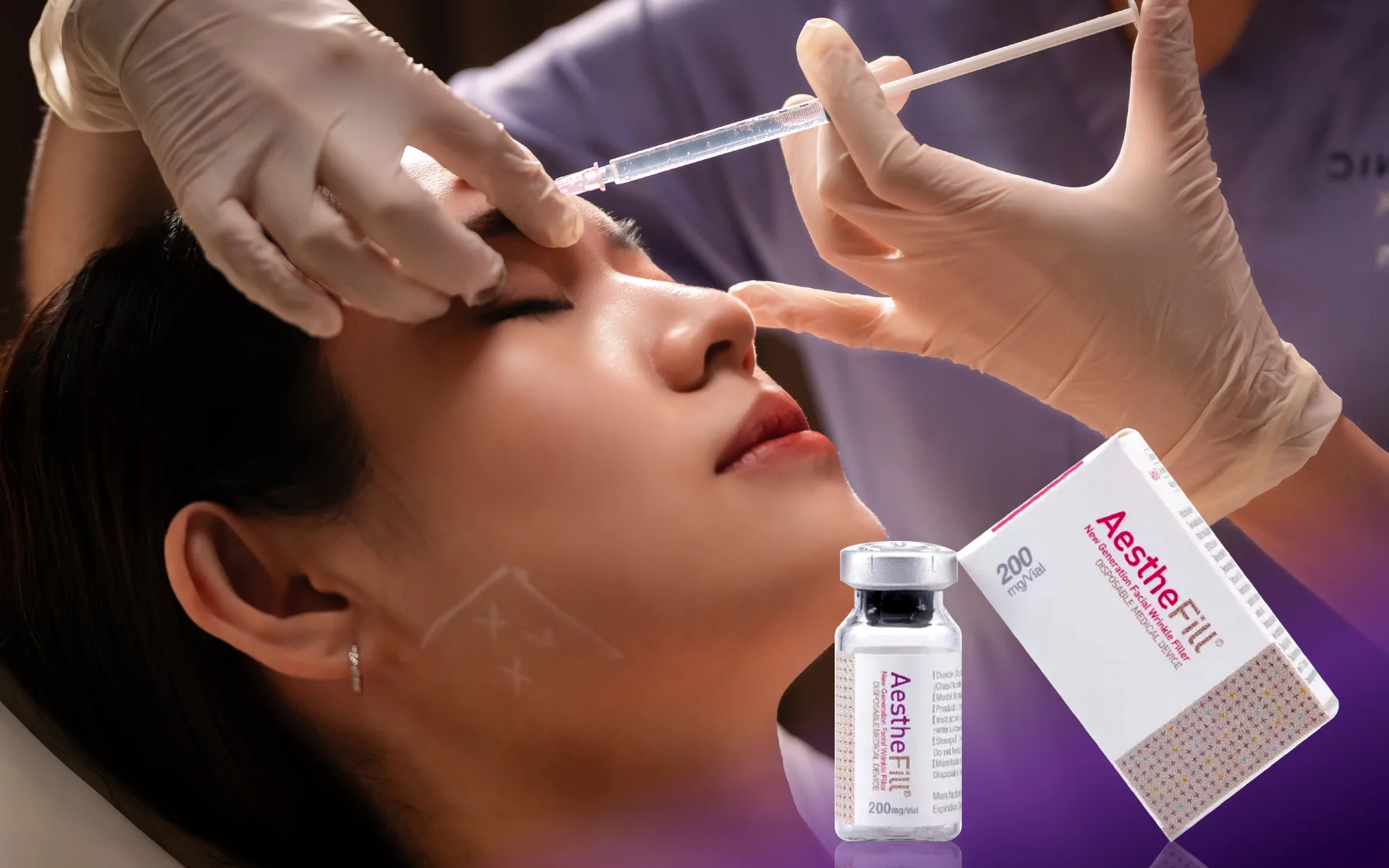 AestheFill treatment at Clinic RX