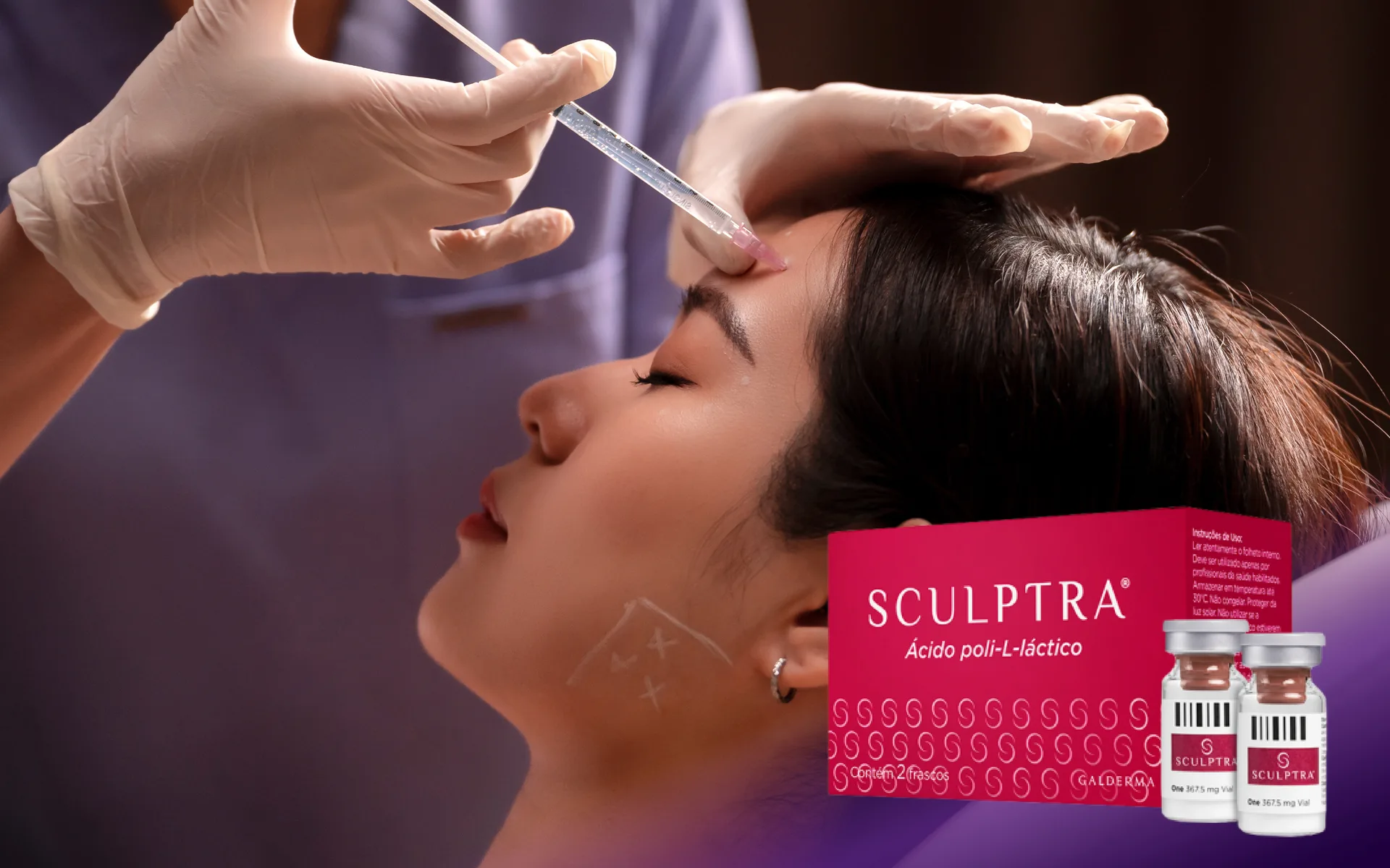 Sculptra treatment at Clinic RX