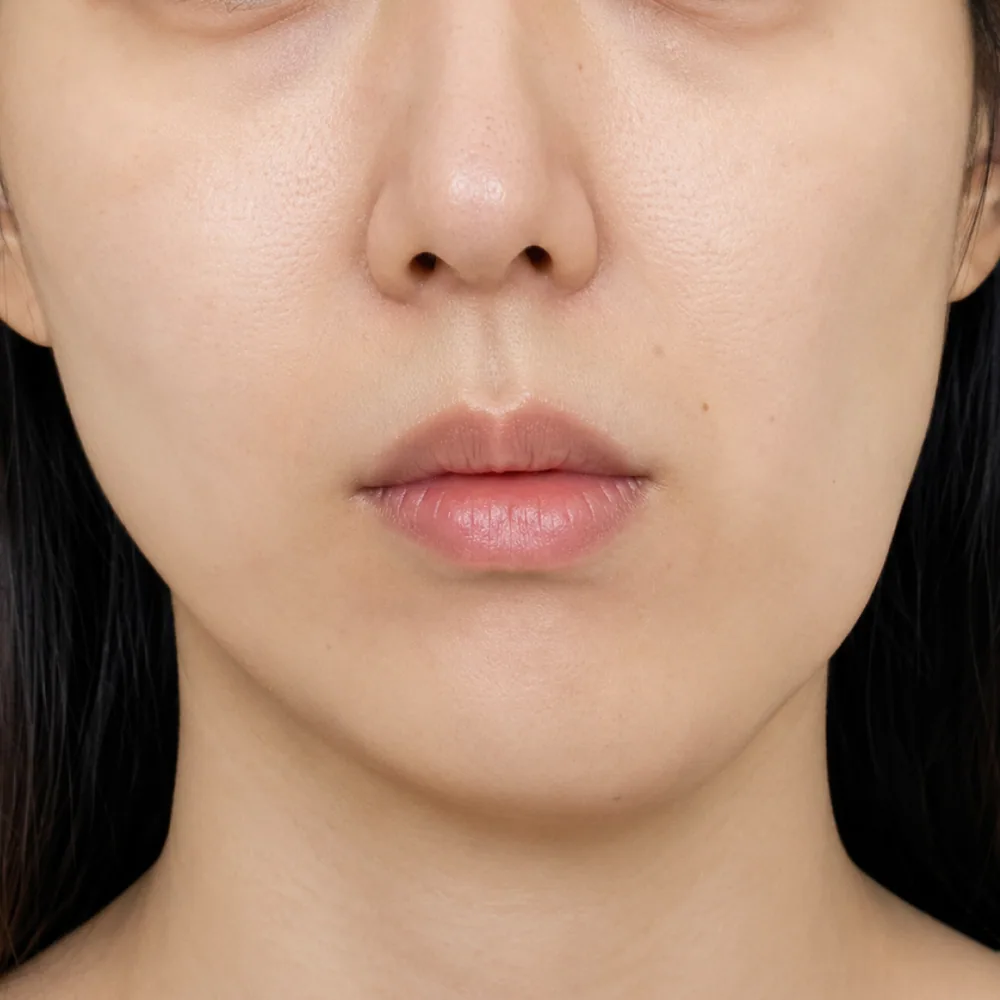 Facial Disharmony — Structural Imbalance