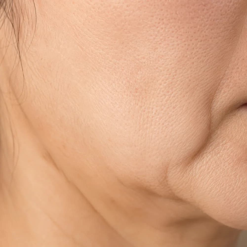 Facial Disharmony — Age-Related Disharmony