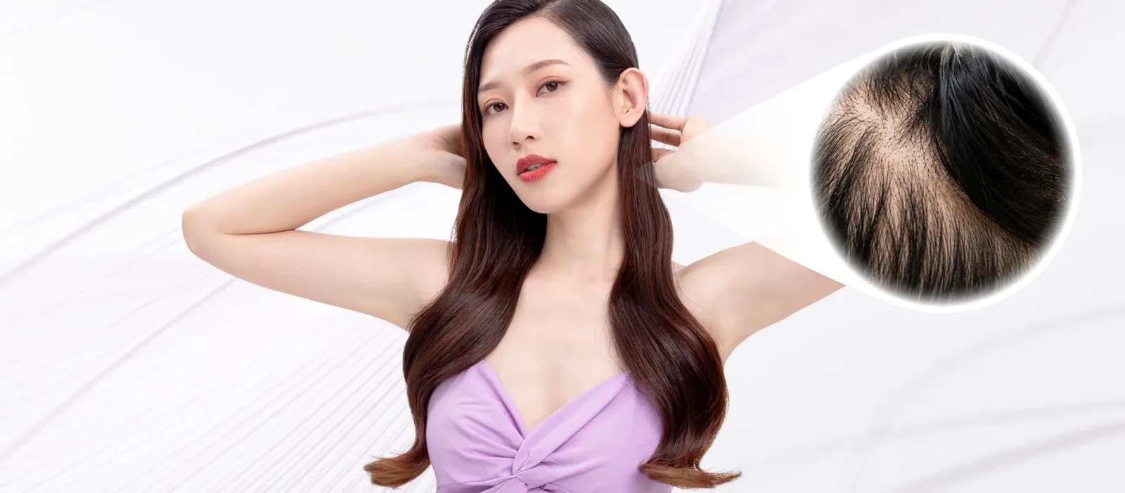 Hair Loss condition overview
