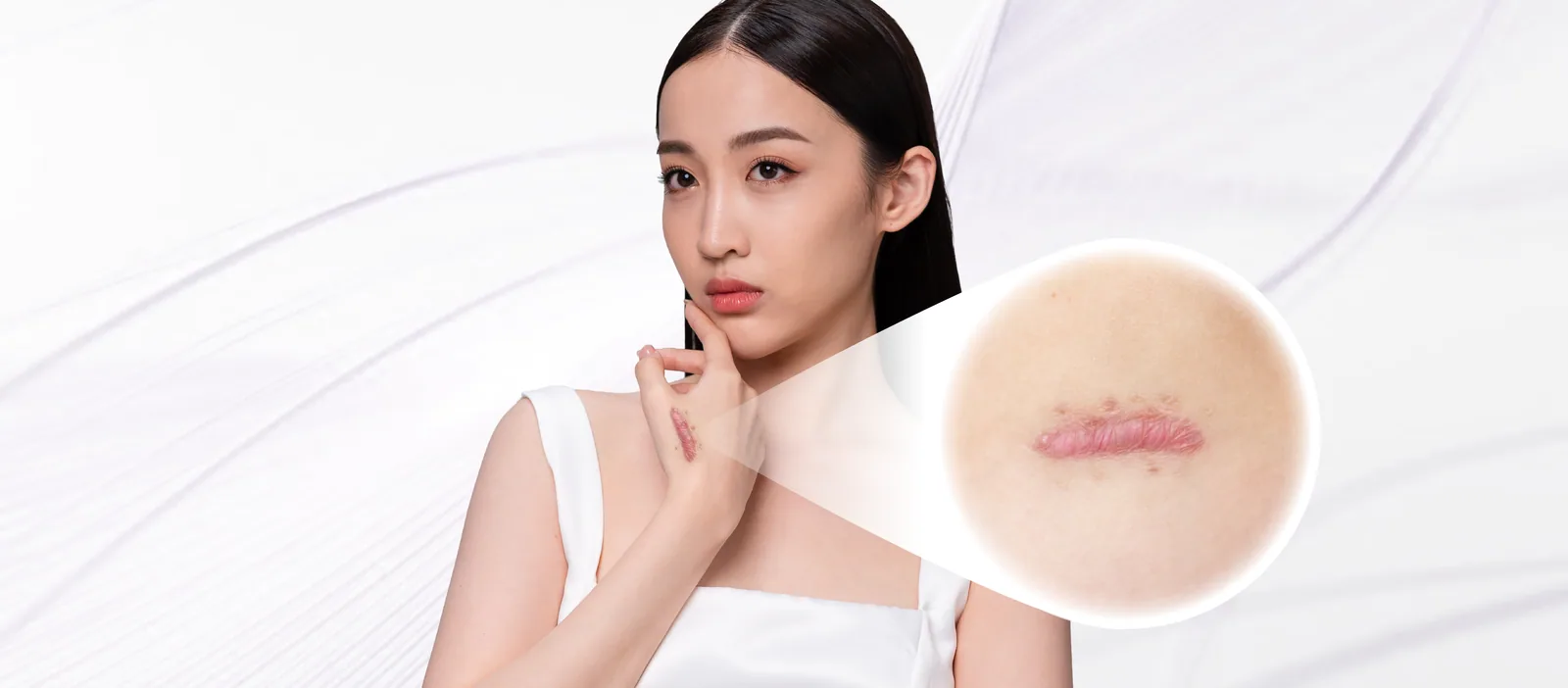 Keloid condition overview