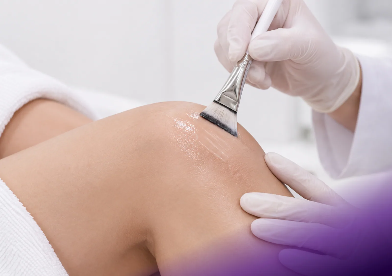Botanical Peel treatment at Clinic RX