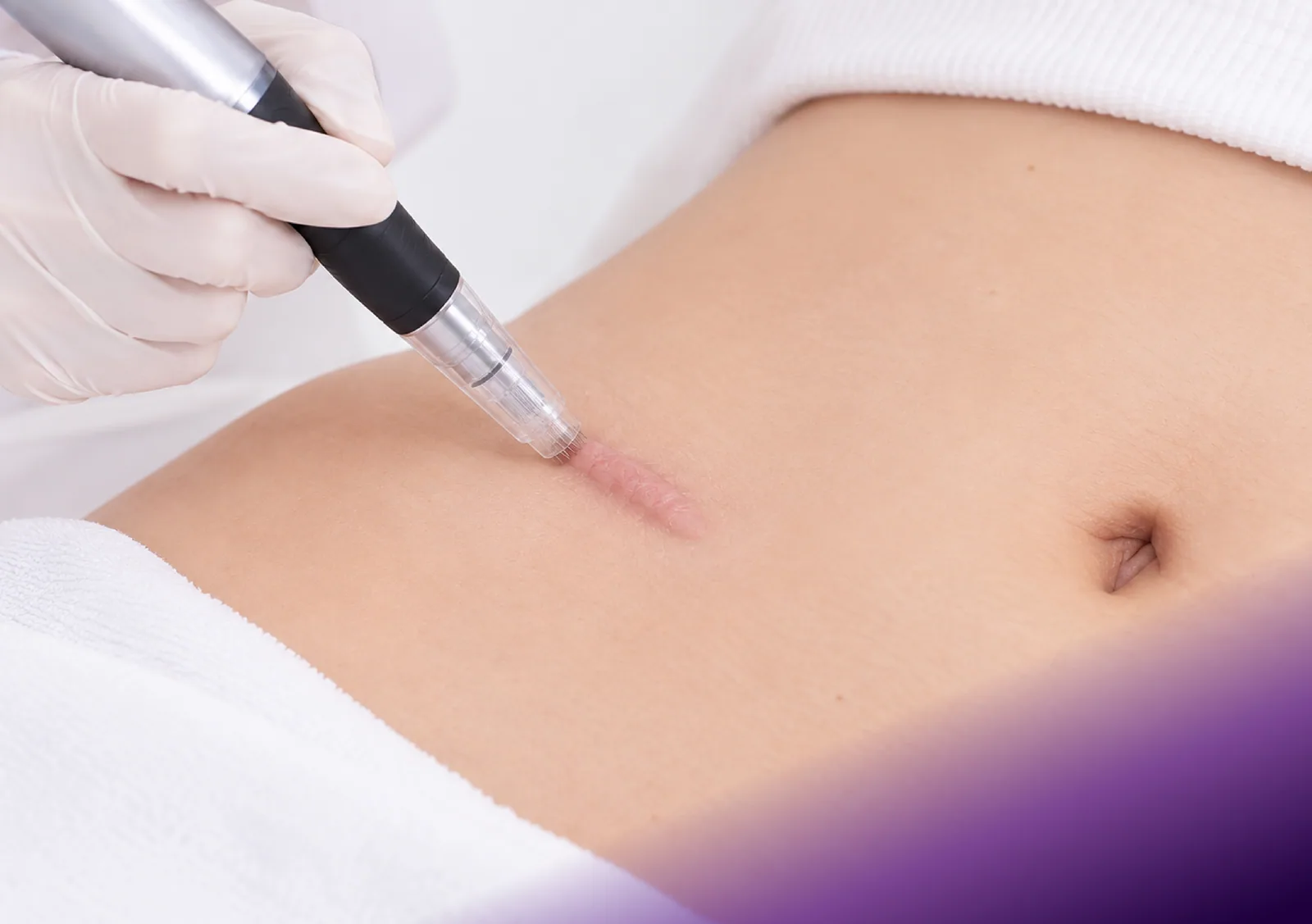 Keloid Removal Injection treatment at Clinic RX
