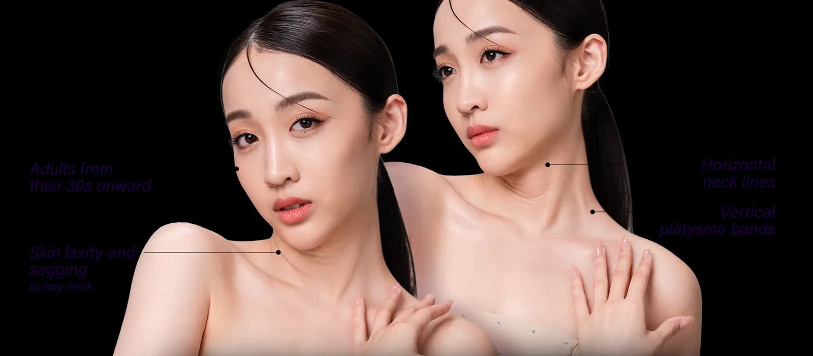 Neck Lines commonly affected areas