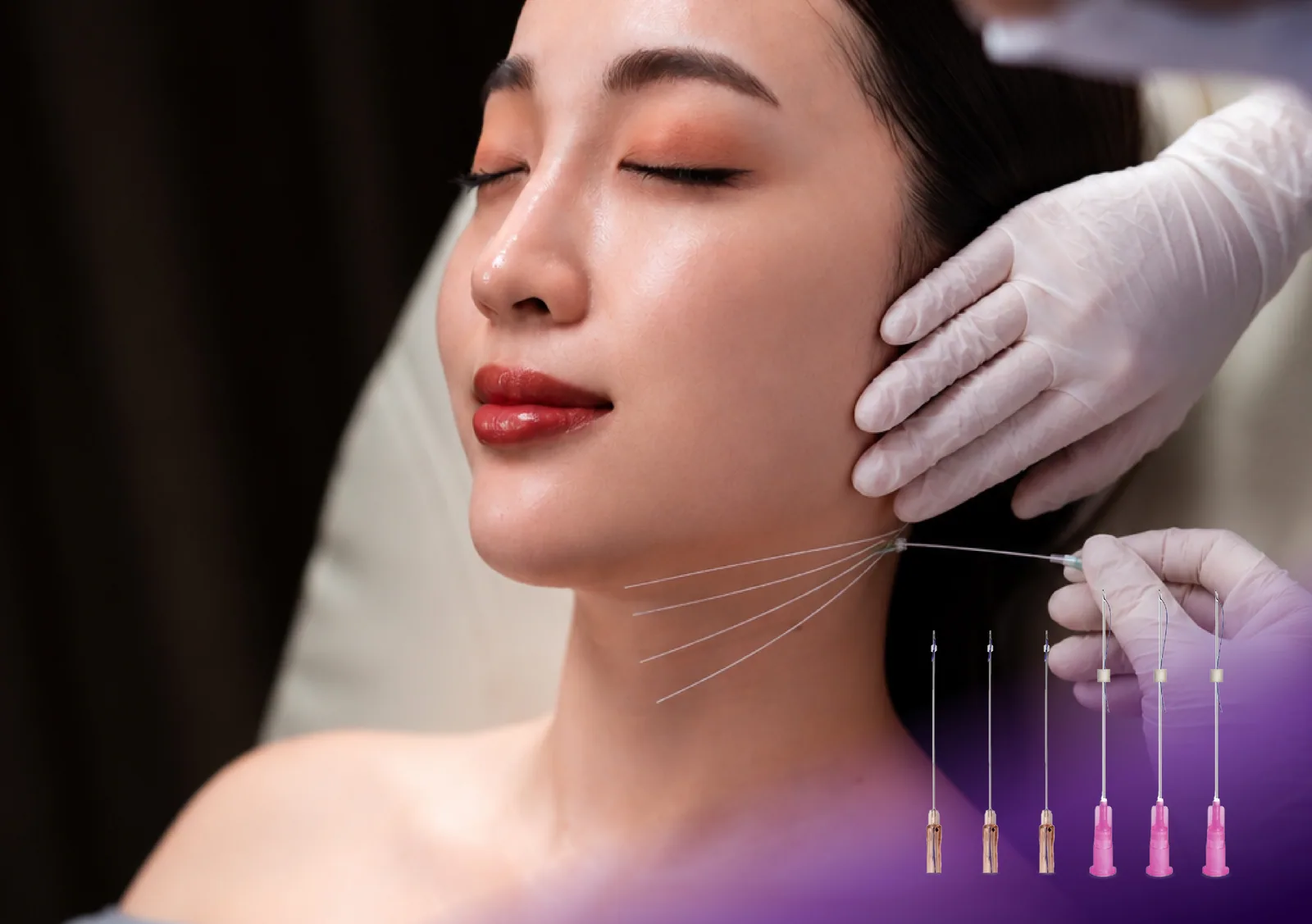 Face Thread Lift treatment at Clinic RX