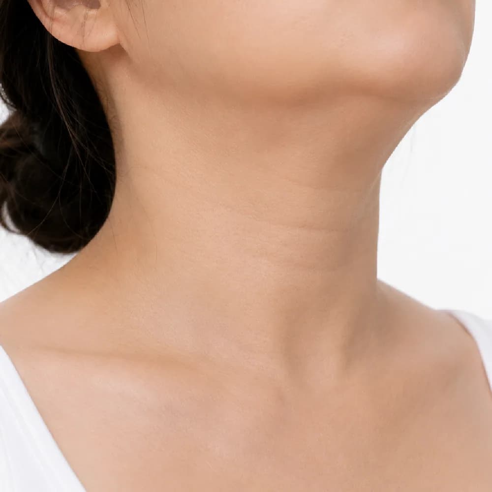 Neck Lines — Loss of Jaw-Neck Definition