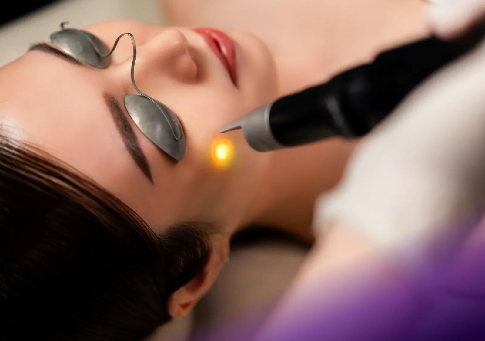 Yellow Laser treatment at Clinic RX