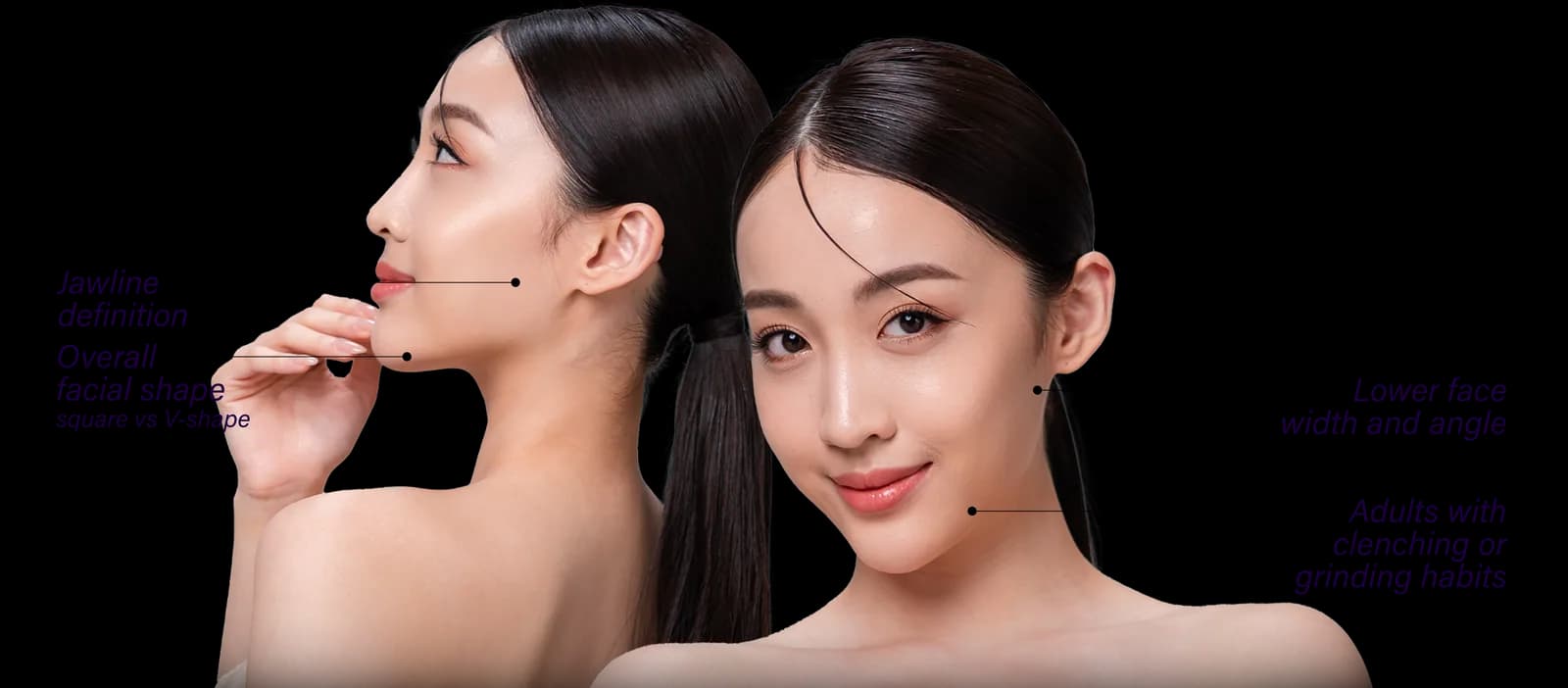 Square Jaw commonly affected areas