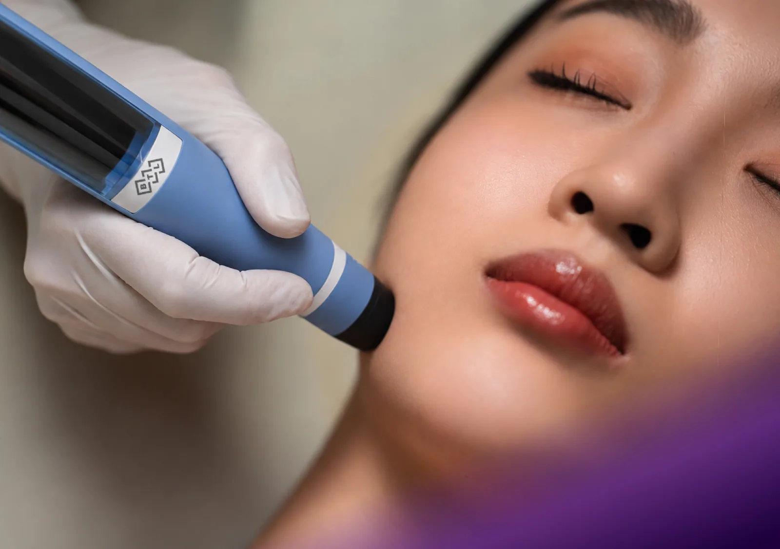 Exion treatment at Clinic RX