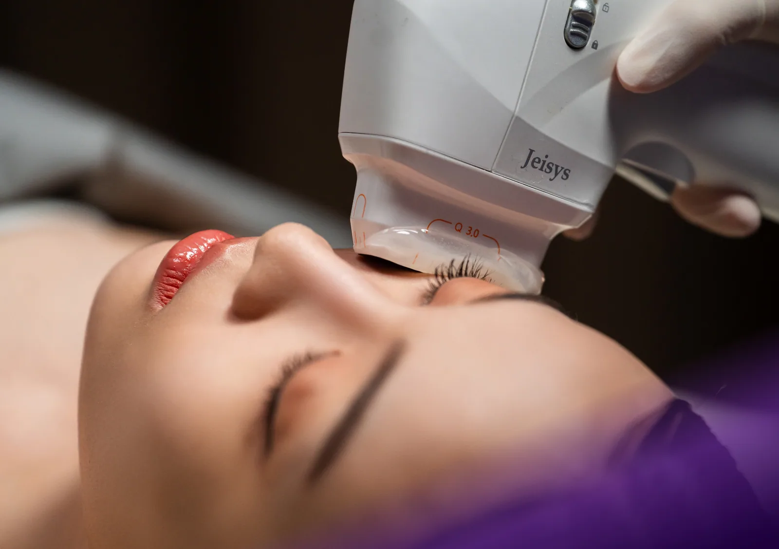 HIFU treatment at Clinic RX