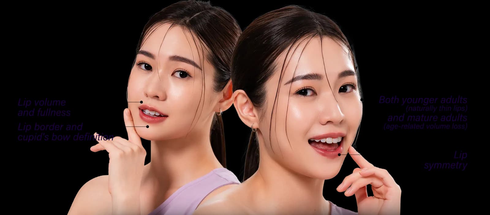 Thin Lips commonly affected areas