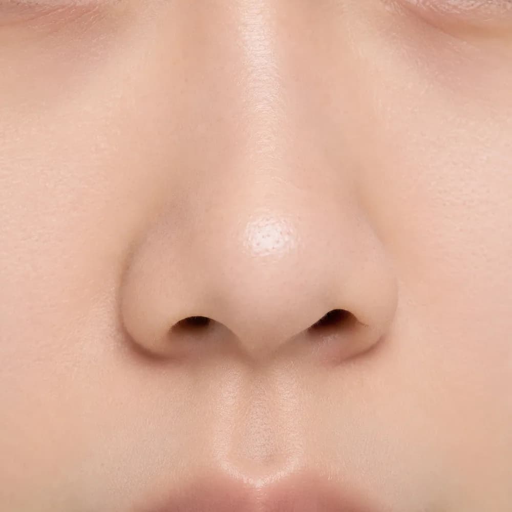 Undefined Nose — Asymmetric Nose