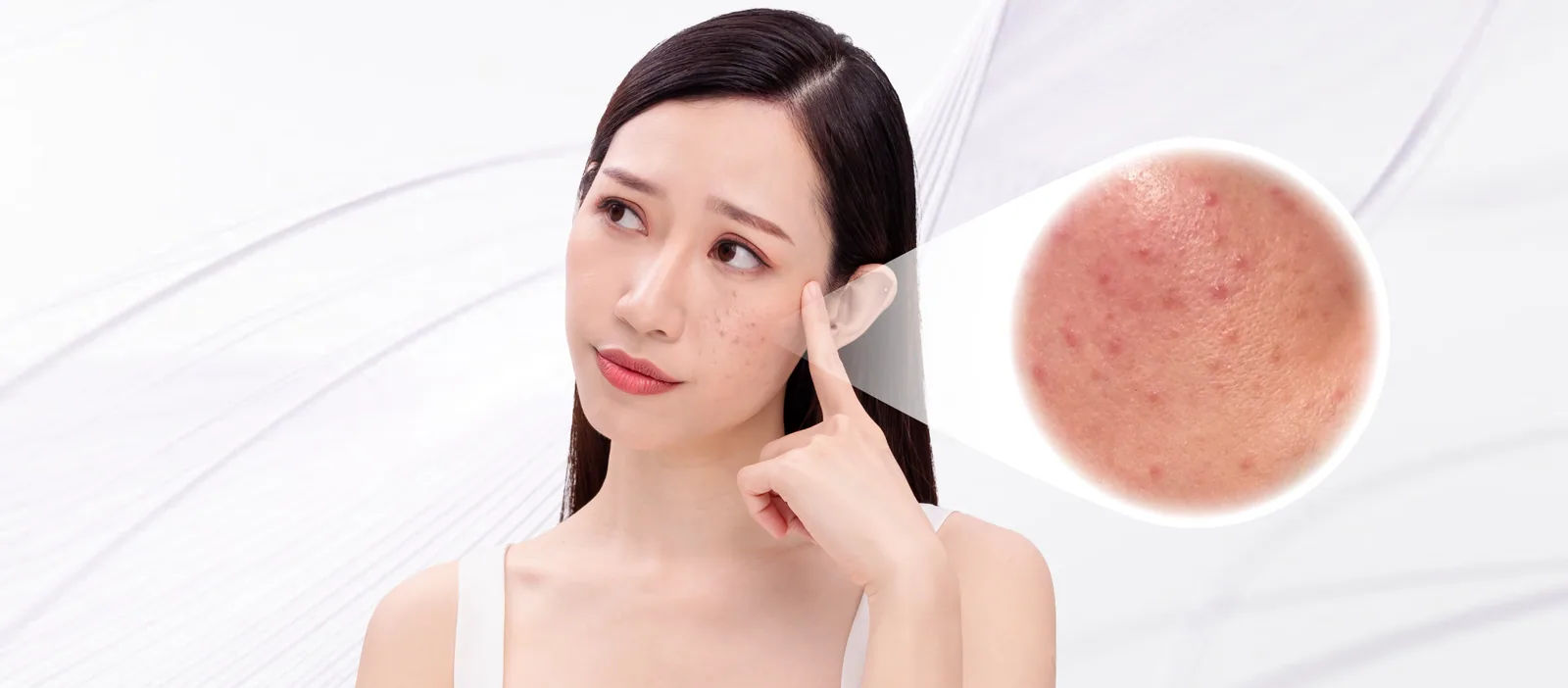 Uneven Skin Texture condition overview