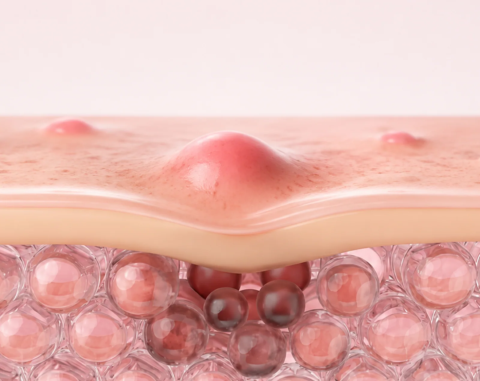 Uneven Skin Texture anatomy and overview