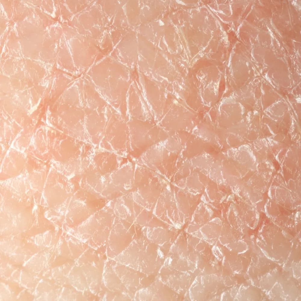 Uneven Skin Texture — Rough, Dry Texture