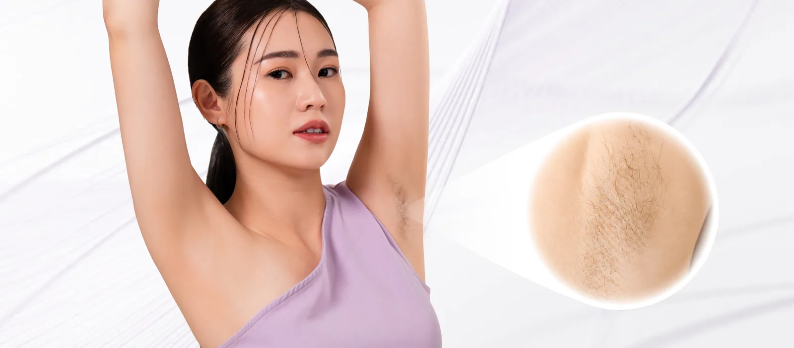 Unwanted Hair condition overview