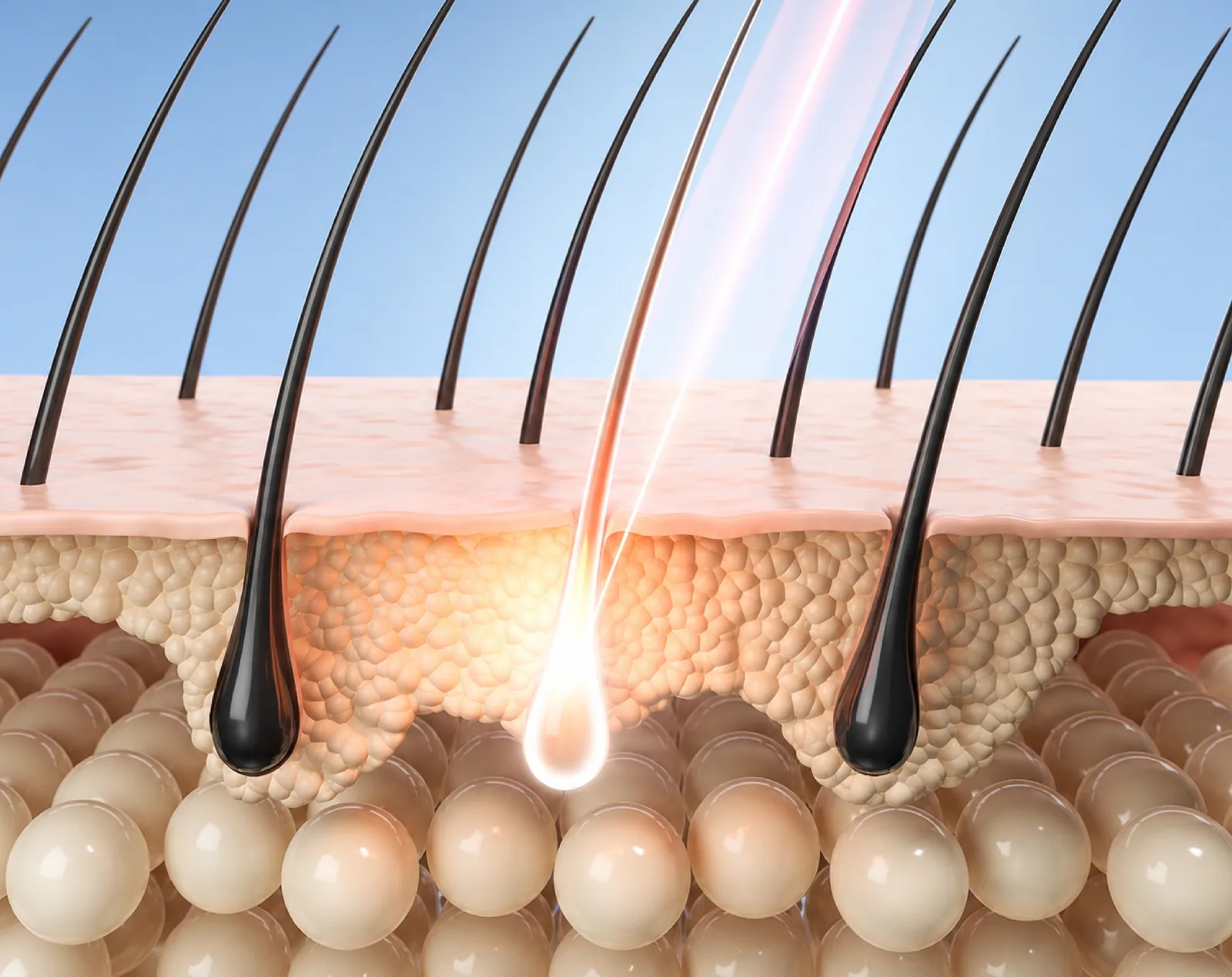 Unwanted Hair anatomy and overview