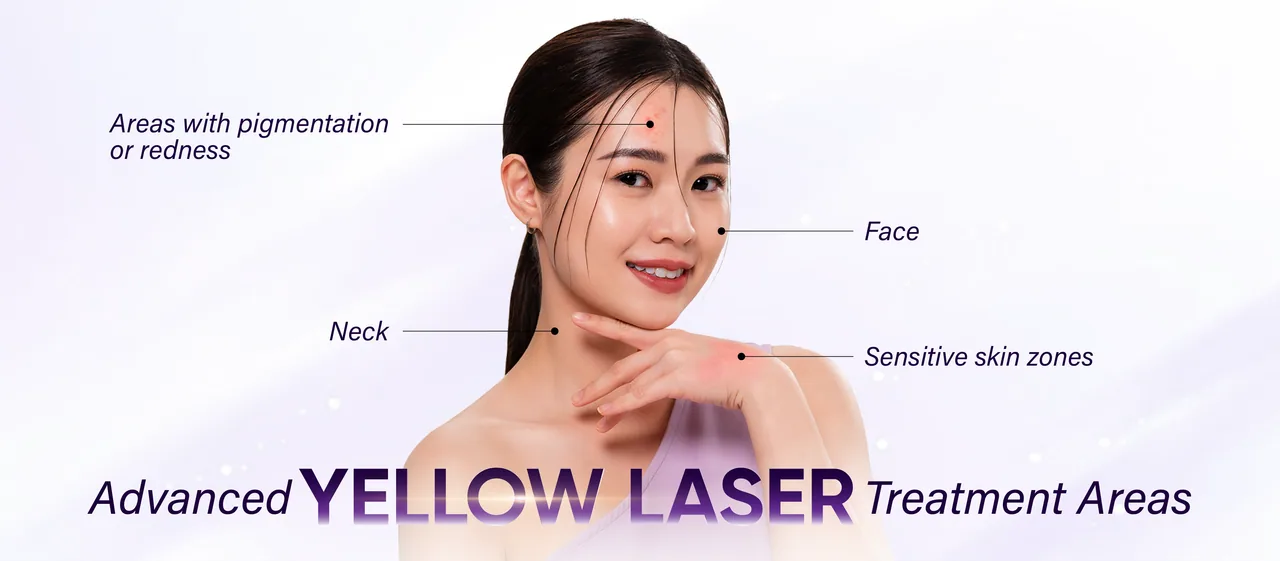 Advanced Yellow Laser treatment areas