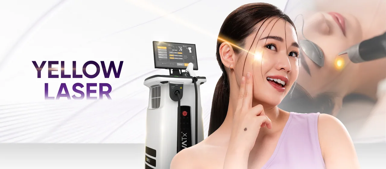 Yellow Laser treatment