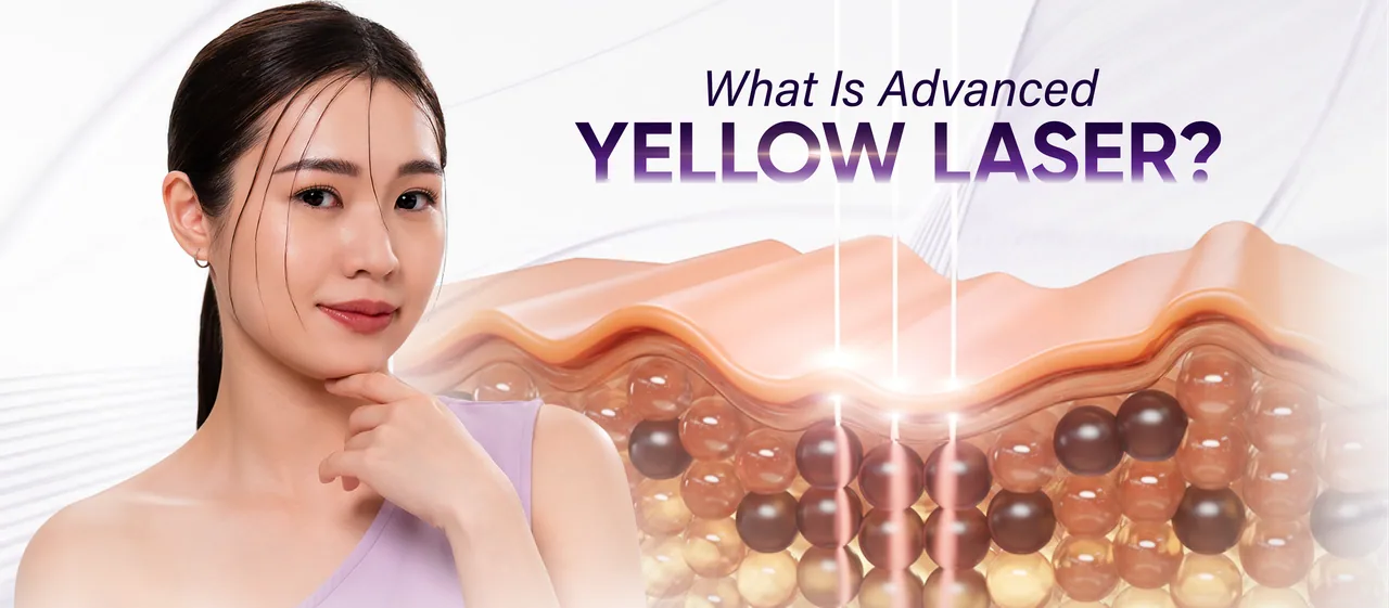 What is Advanced Yellow Laser