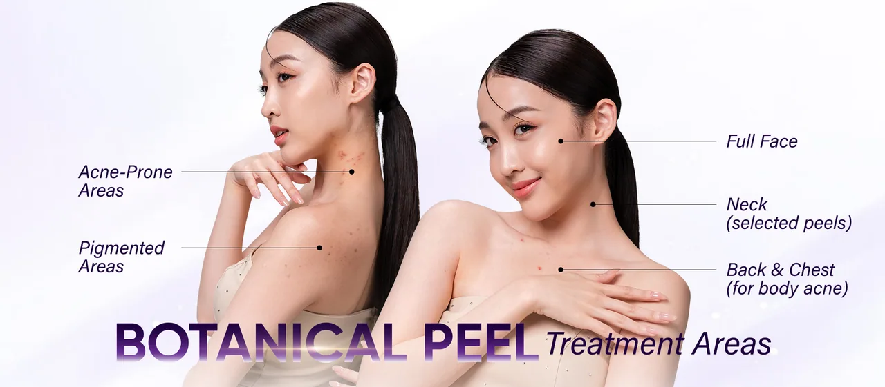 Botanical Peel treatment areas