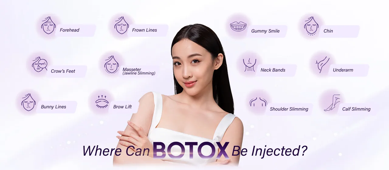 Botulinum Toxin treatment areas