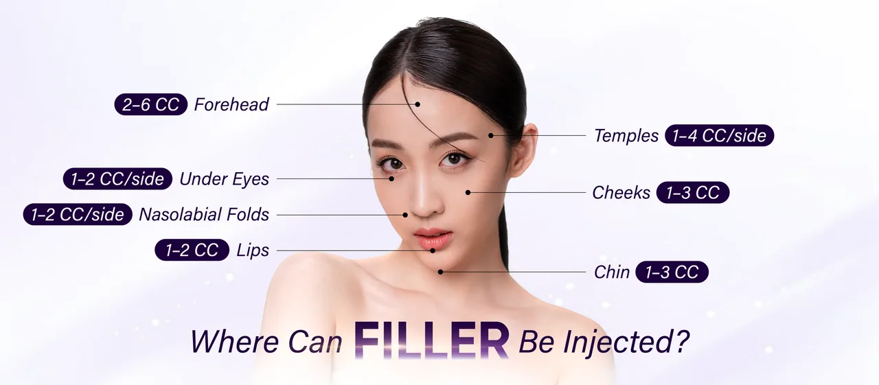 Dermal Filler treatment areas