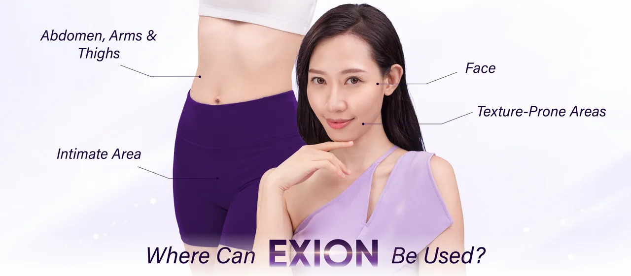 Exion treatment areas