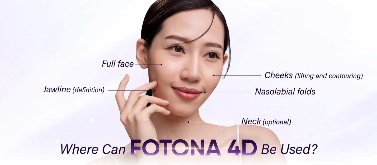 Fotona 4D treatment areas