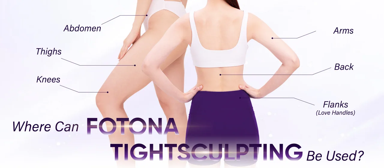 Fotona TightSculpting treatment areas