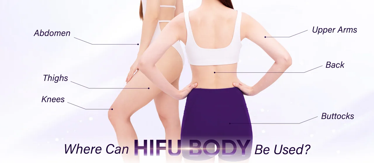 HIFU Body treatment areas