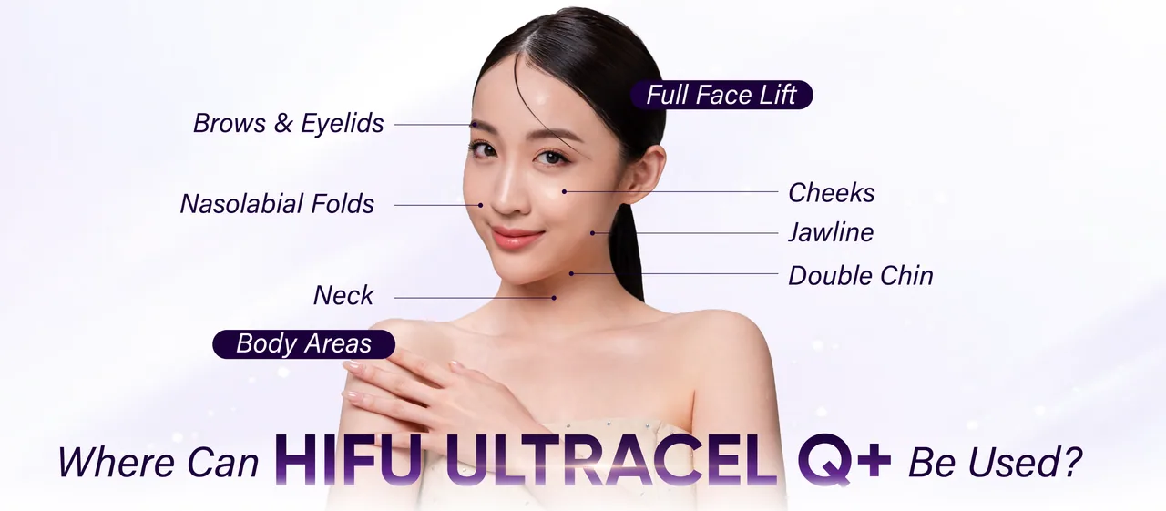 HIFU Ultracel Q+ treatment areas