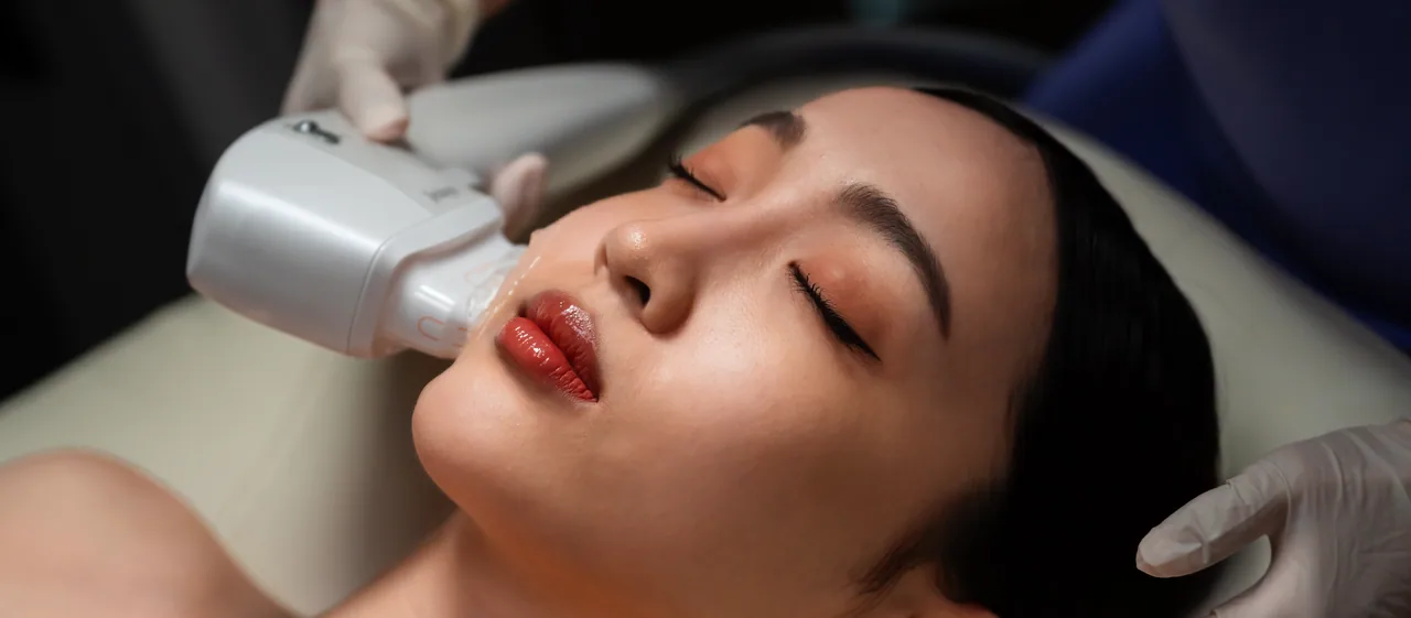 HIFU Ultracel Q+ lower face treatment
