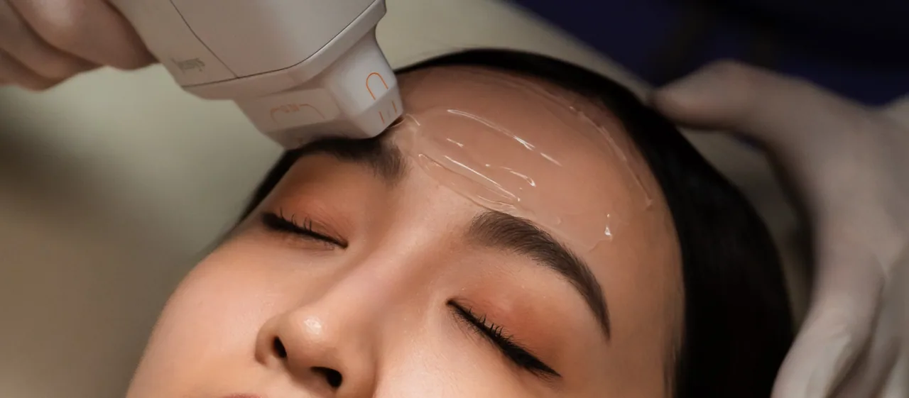 HIFU Ultracel Q+ brow area treatment