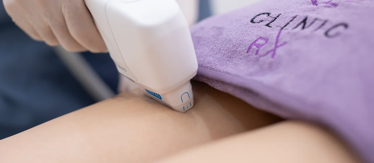 HIFU Ultracel Q+ body treatment