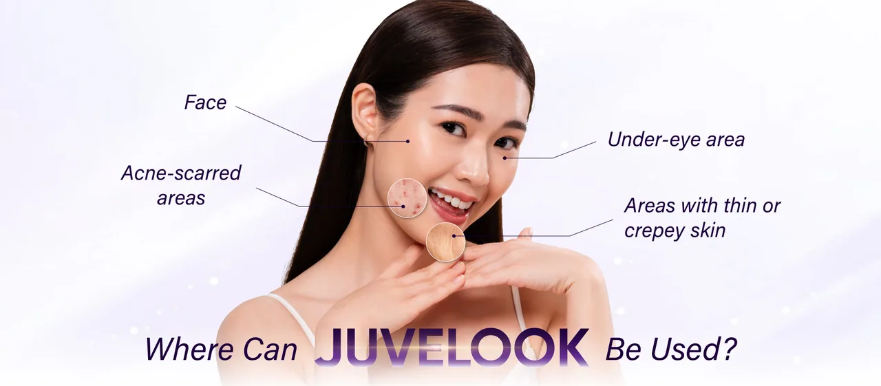 Juvelook treatment areas
