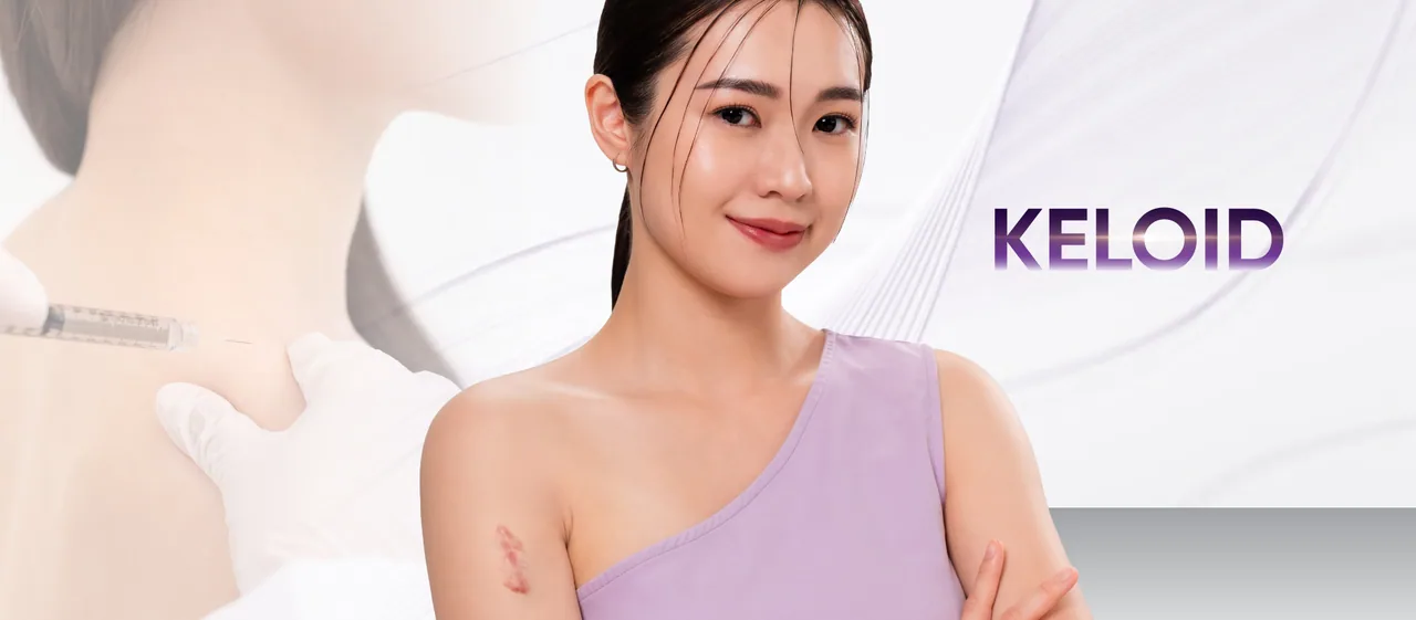 Keloid Removal treatment