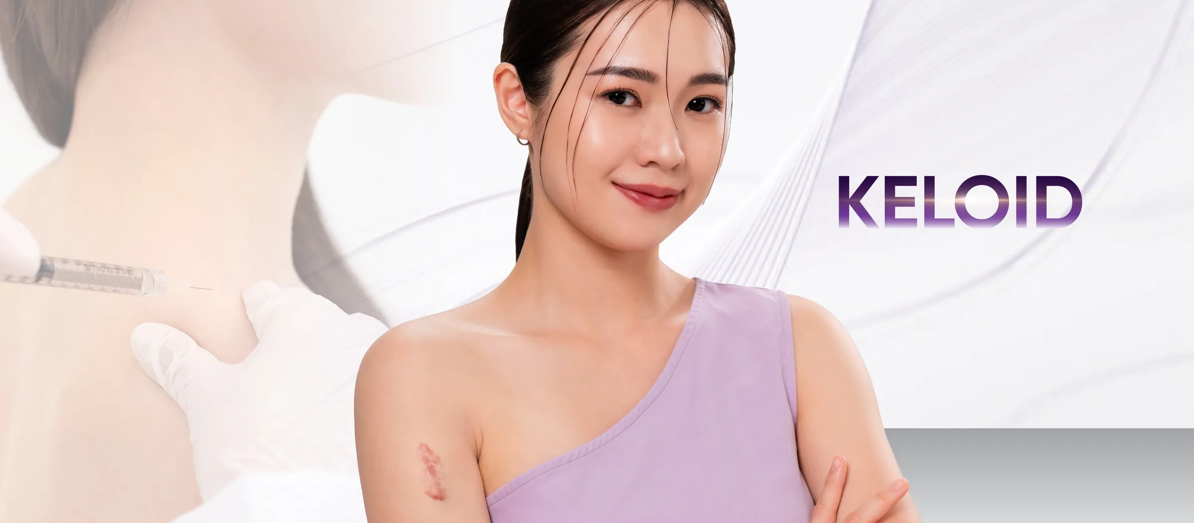 Keloid Removal treatment